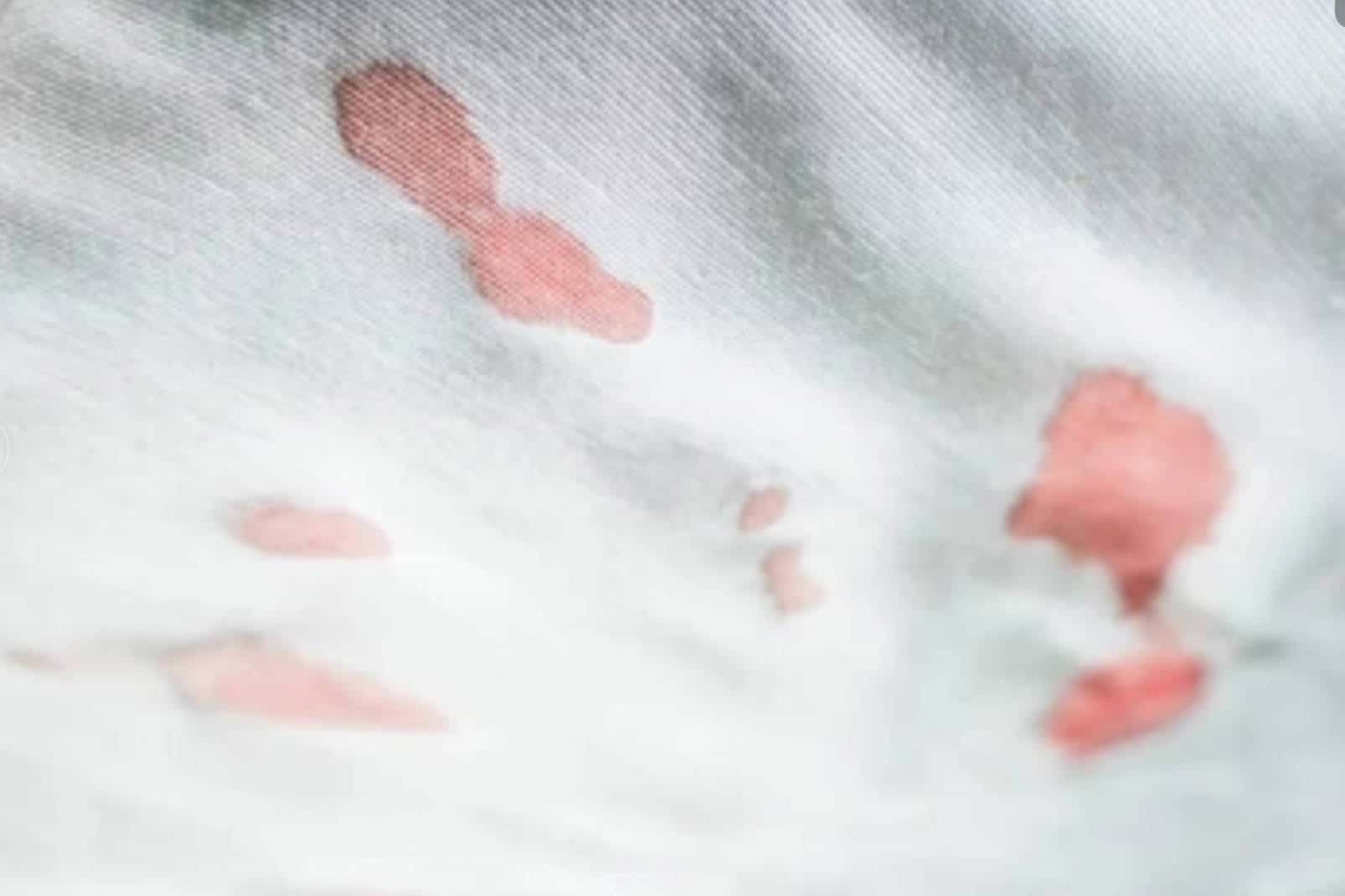 Dried Cherry Juice Stains from Clothes